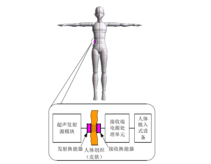 植入式醫療設備超聲波耦合無線電能傳輸模型.png