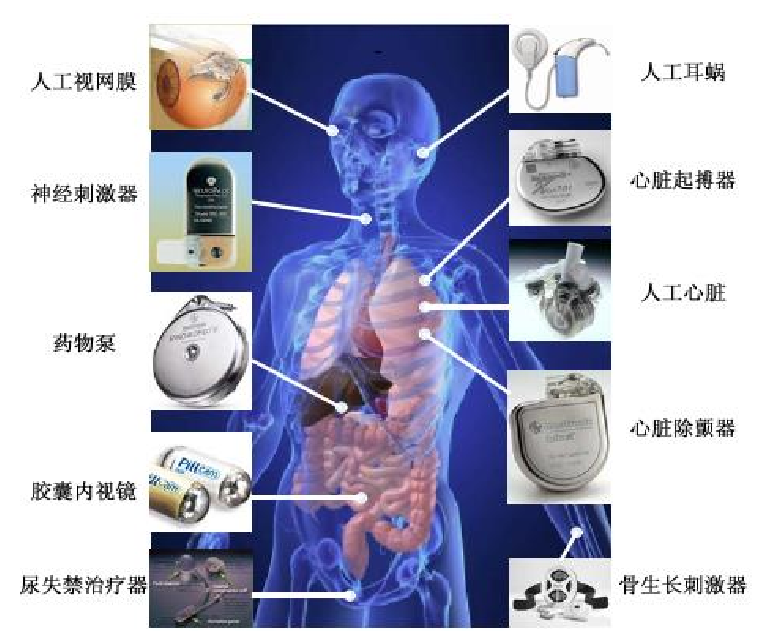 高壓放大器應用植入式電子設備人體布圖.png